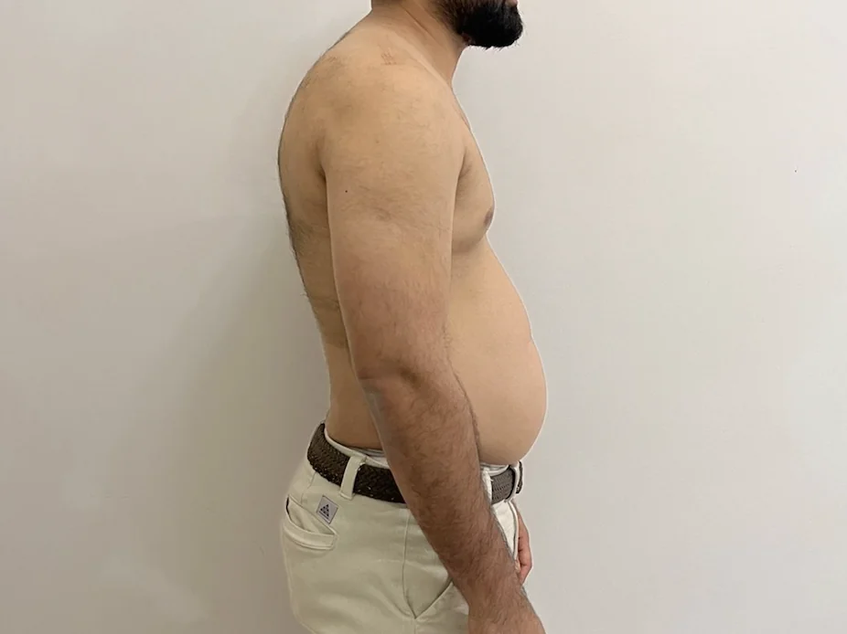Bilal — before