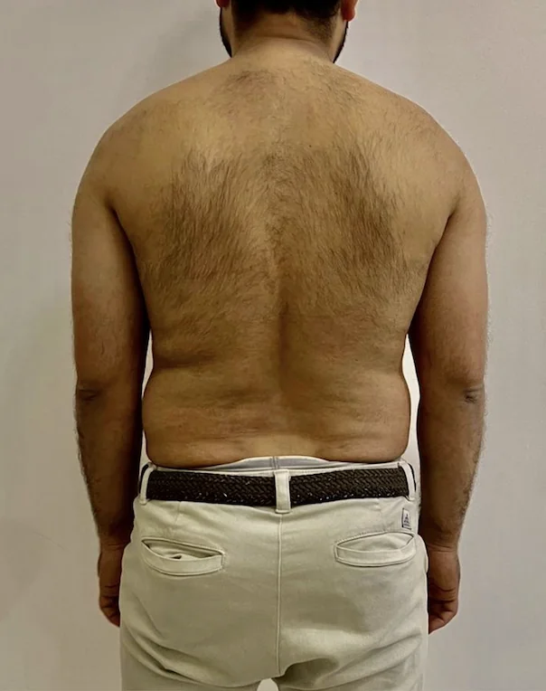 Bilal back — before